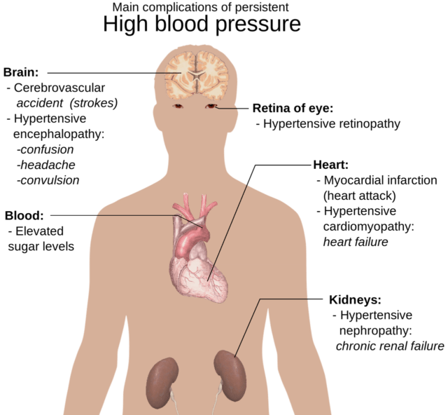 human body anatomy, overview, hypertension-1279987.jpg